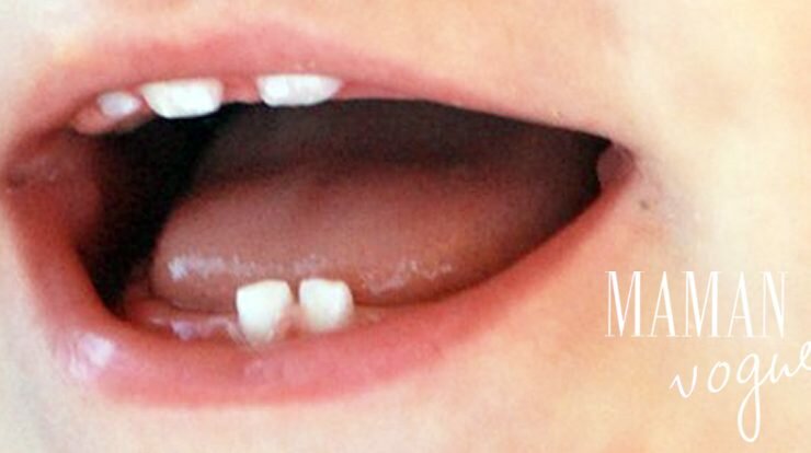 Soigner Les Dents Par L Homeopathie Maman Vogue